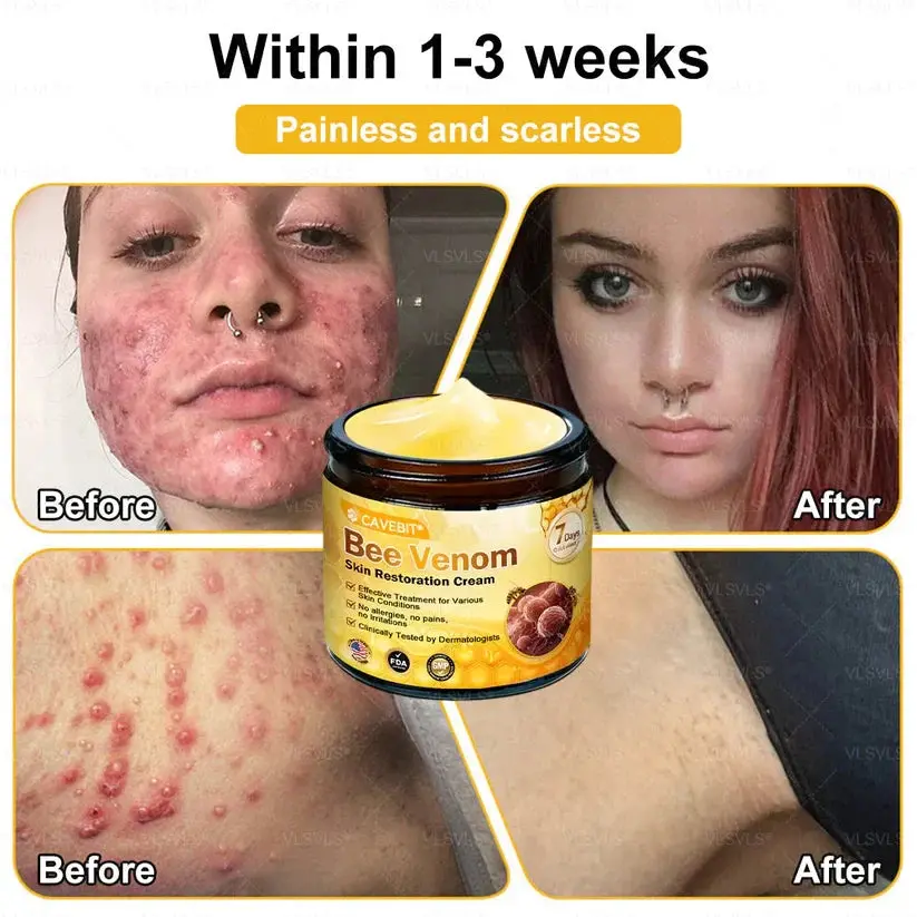 Cavebit® Bee Venom Skin Restoration Cream