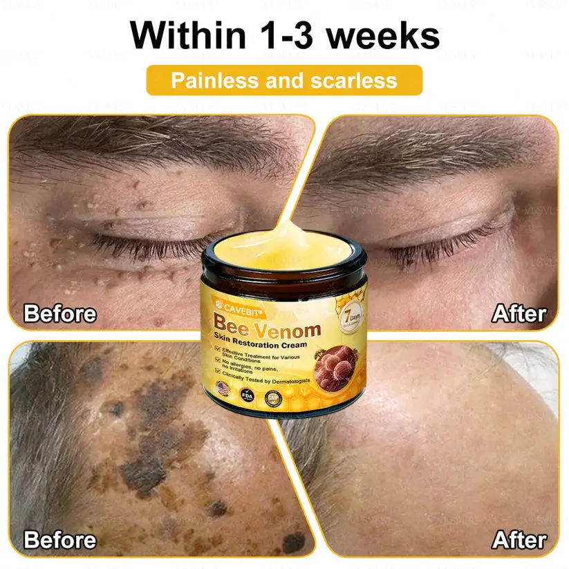 Cavebit® Bee Venom Skin Restoration Cream