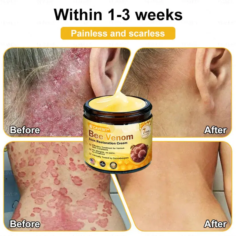 Cavebit® Bee Venom Skin Restoration Cream