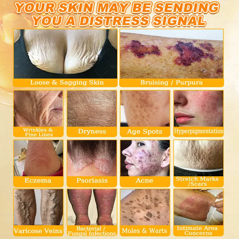 Cavebit® Bee Venom Skin Restoration Cream