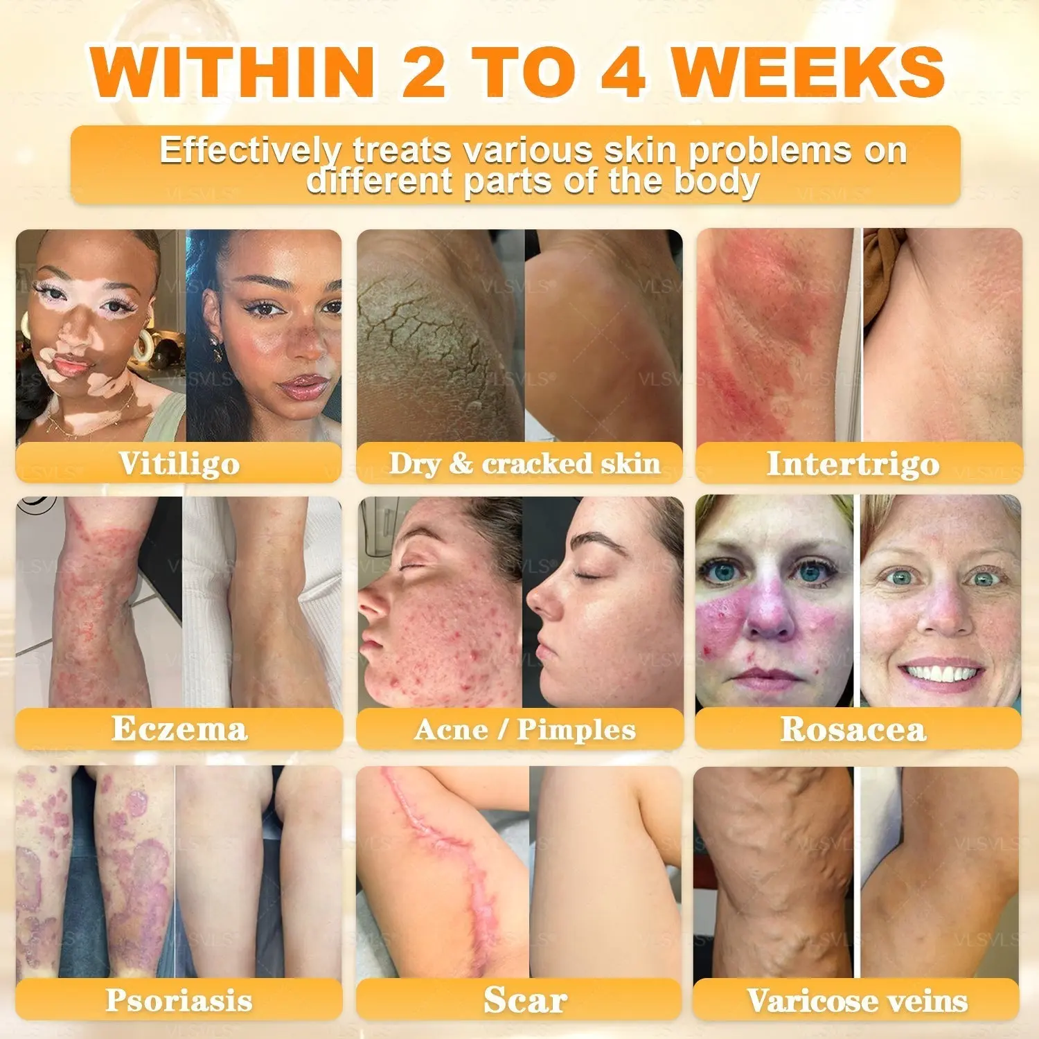 Cavebit® Bee Venom Skin Restoration Cream