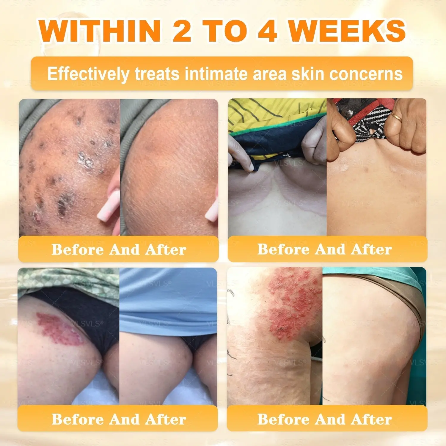 Cavebit® Bee Venom Skin Restoration Cream