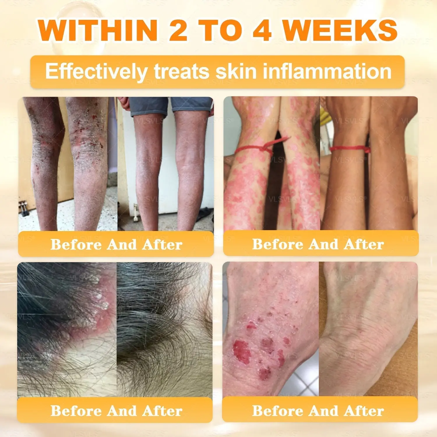 Cavebit® Bee Venom Skin Restoration Cream