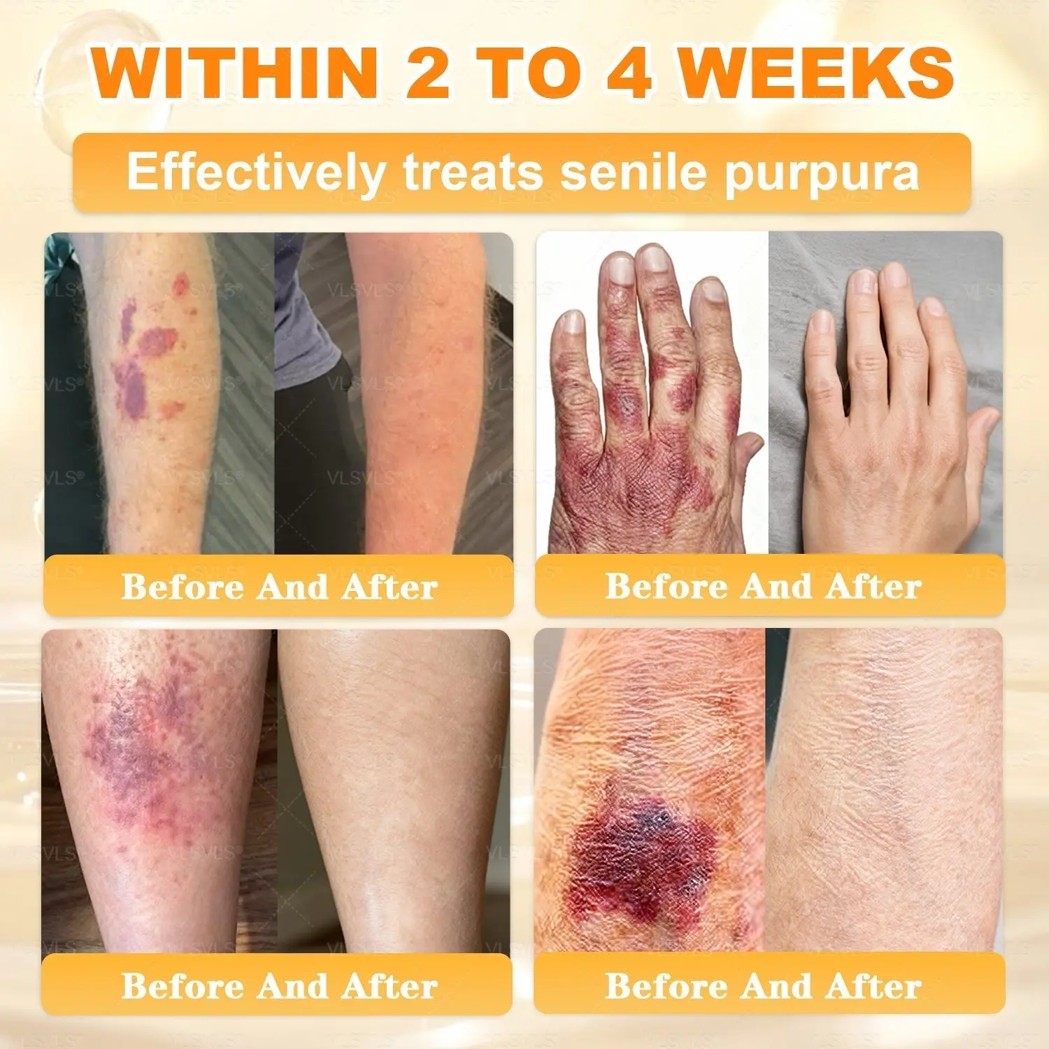 Cavebit® Bee Venom Skin Restoration Cream