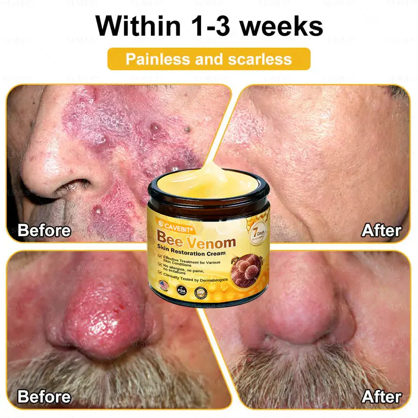 Cavebit® Bee Venom Skin Restoration Cream