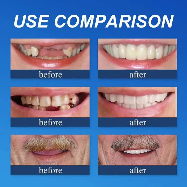 Cavebit™ Medical Full Denture with Strong Suctiond