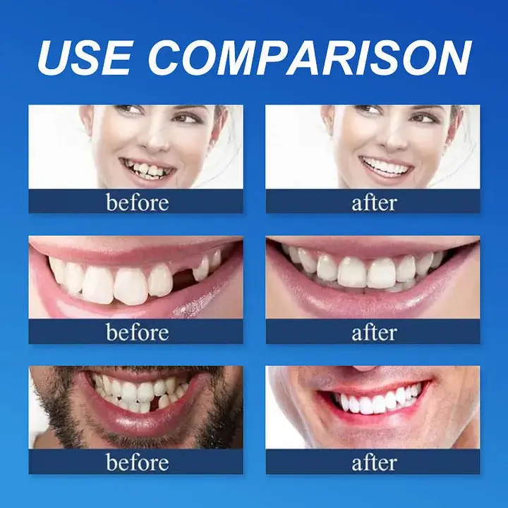 Cavebit™ Medical Full Denture with Strong Suctiond