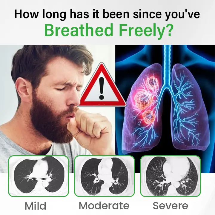 Cavebit® Pulmovia Quercetin Lung Detox Inhaler