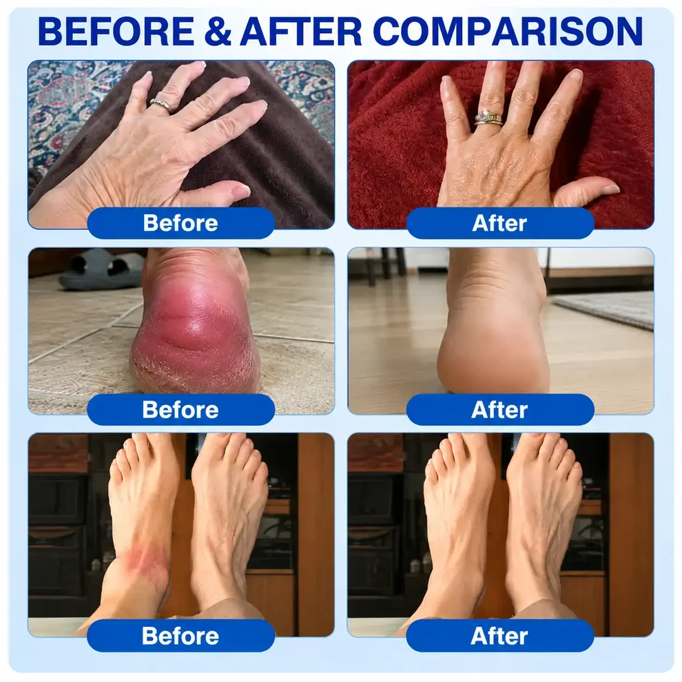 GFOUK® ArthriCare Diclofenac Advanced Formula Joint Comfort & Mobility Cream - Image 3