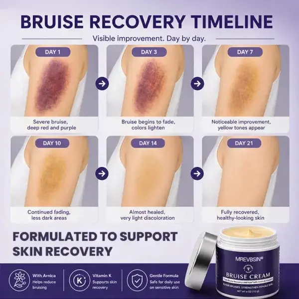 Bruise Recovery Cream - Image 9