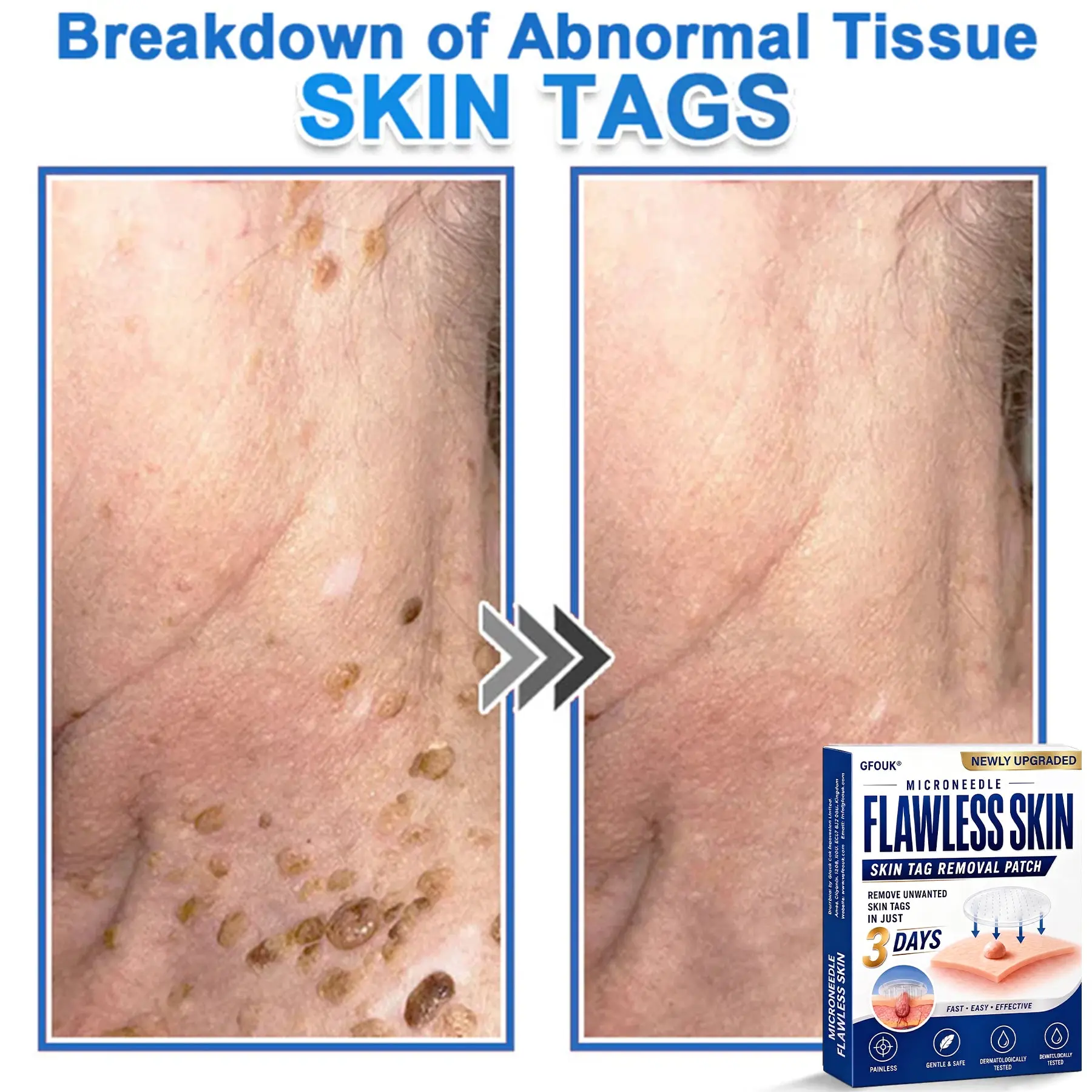 GFOUK® 2026 Newly Upgraded 2-in-1 Microneedle Hydrocolloid Patches - Image 11