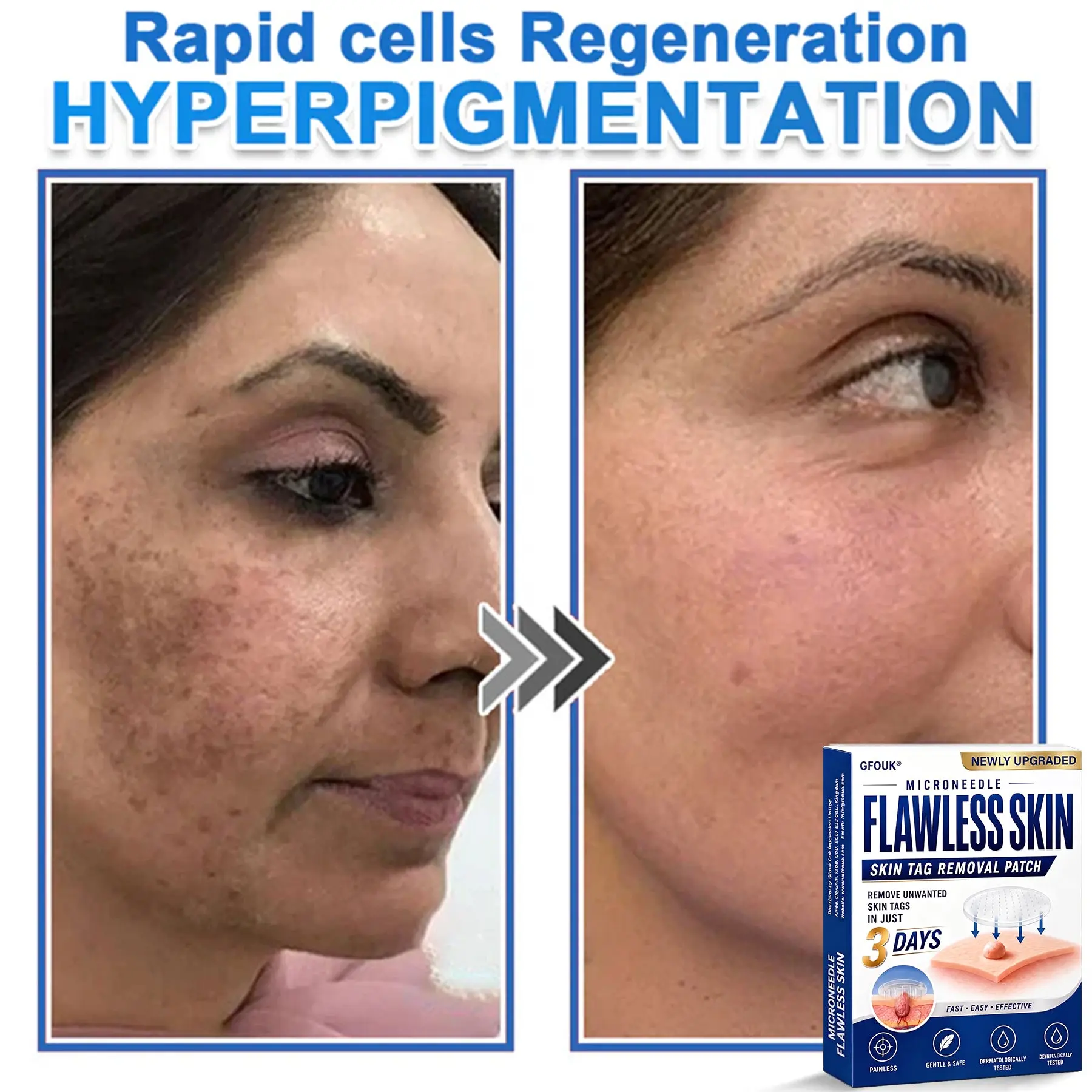 GFOUK® 2026 Newly Upgraded 2-in-1 Microneedle Hydrocolloid Patches - Image 14
