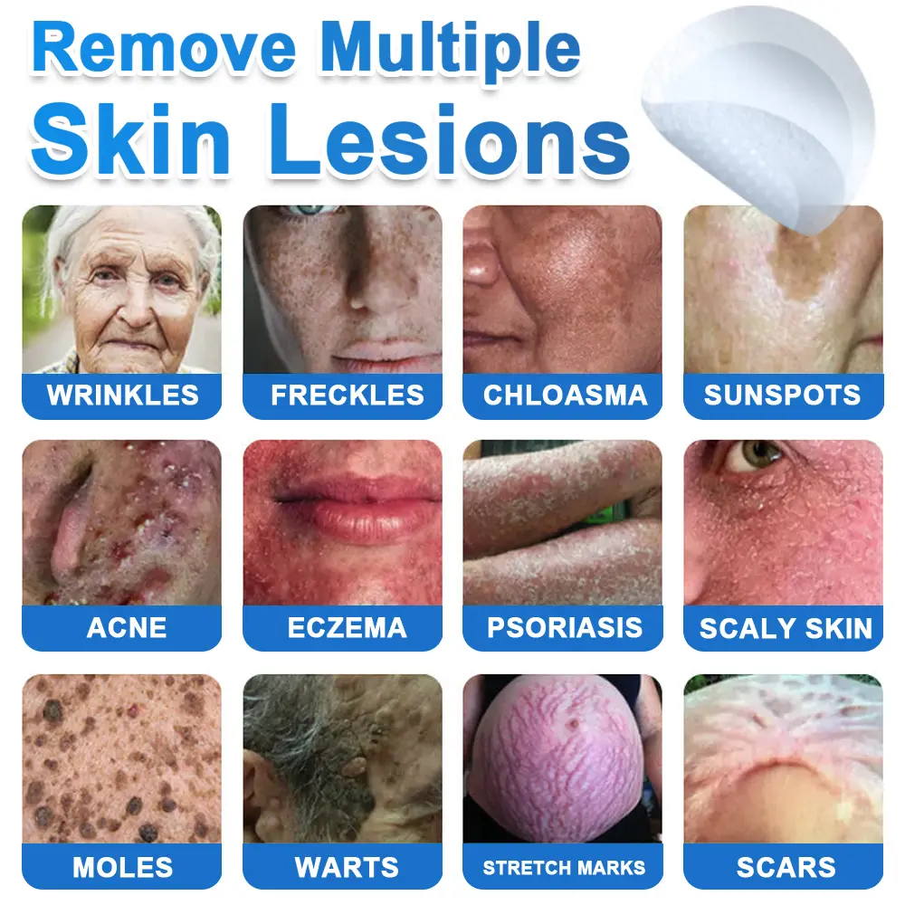 GFOUK® 2026 Newly Upgraded 2-in-1 Microneedle Hydrocolloid Patches - Image 2