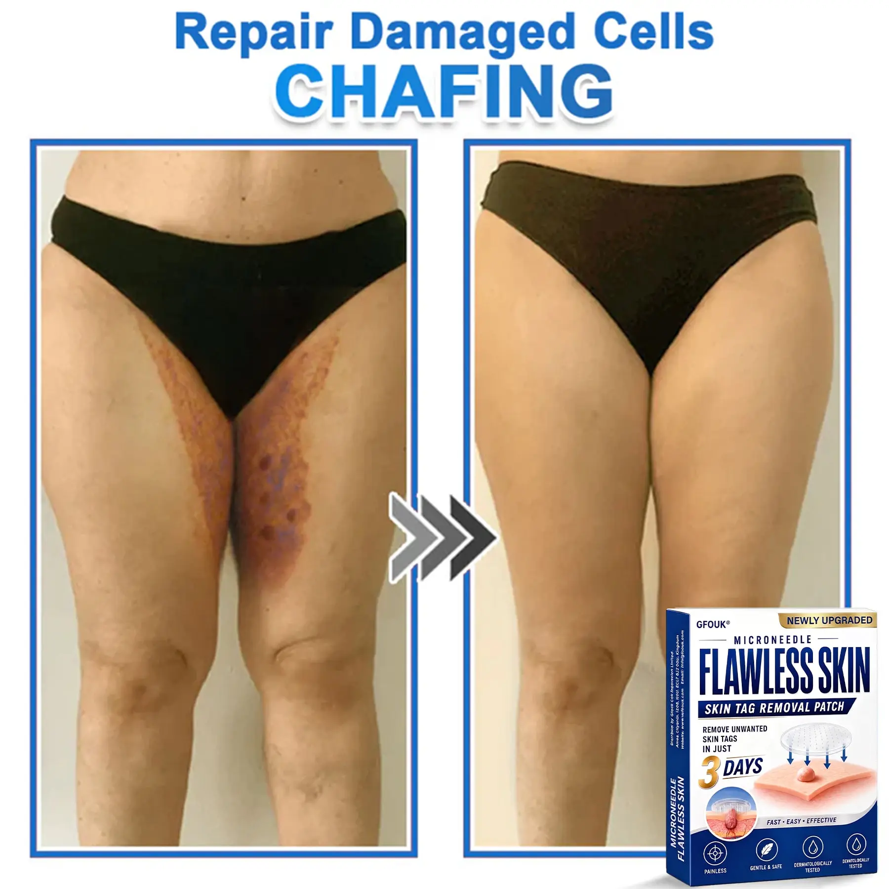 GFOUK® 2026 Newly Upgraded 2-in-1 Microneedle Hydrocolloid Patches - Image 4