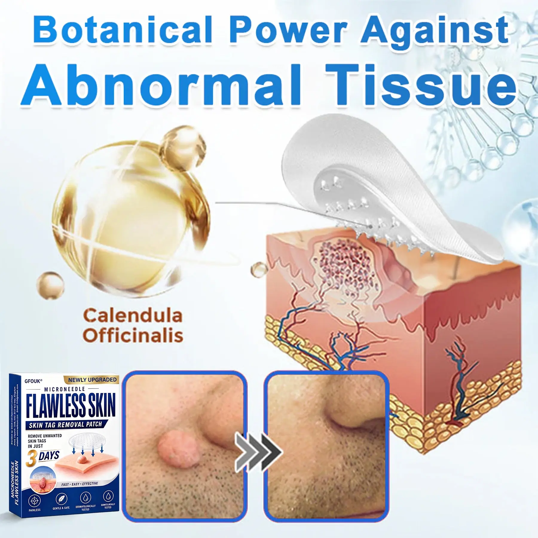 GFOUK® 2026 Newly Upgraded 2-in-1 Microneedle Hydrocolloid Patches - Image 5