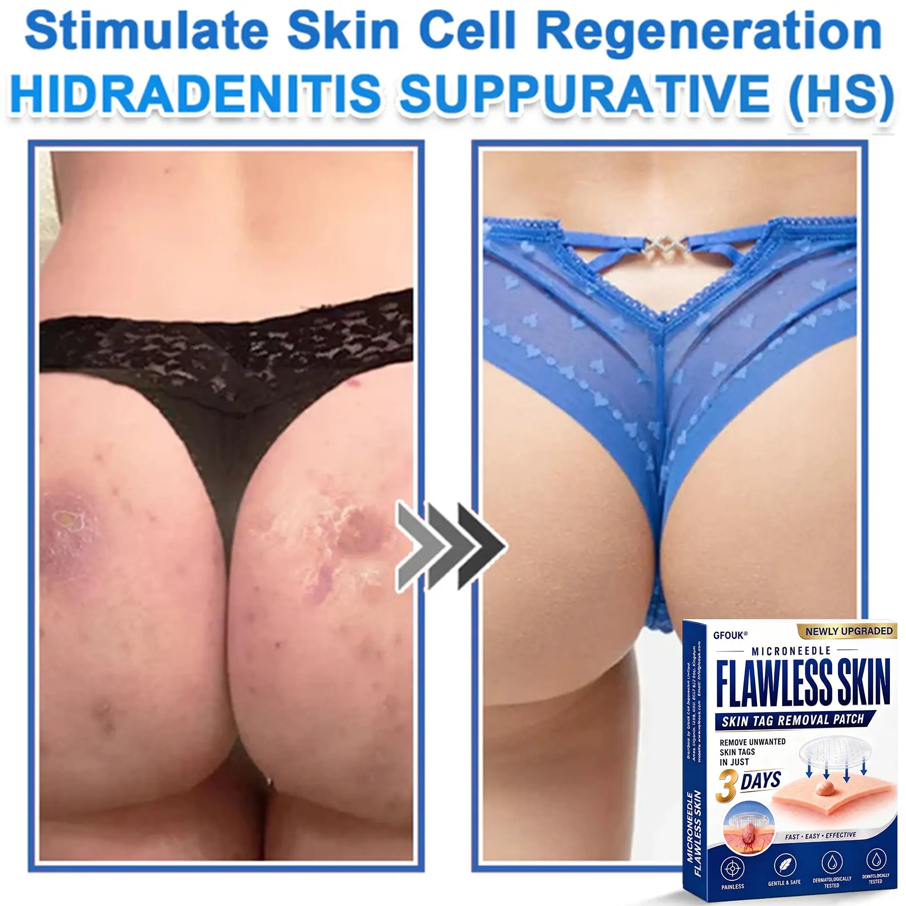 GFOUK® 2026 Newly Upgraded 2-in-1 Microneedle Hydrocolloid Patches - Image 9