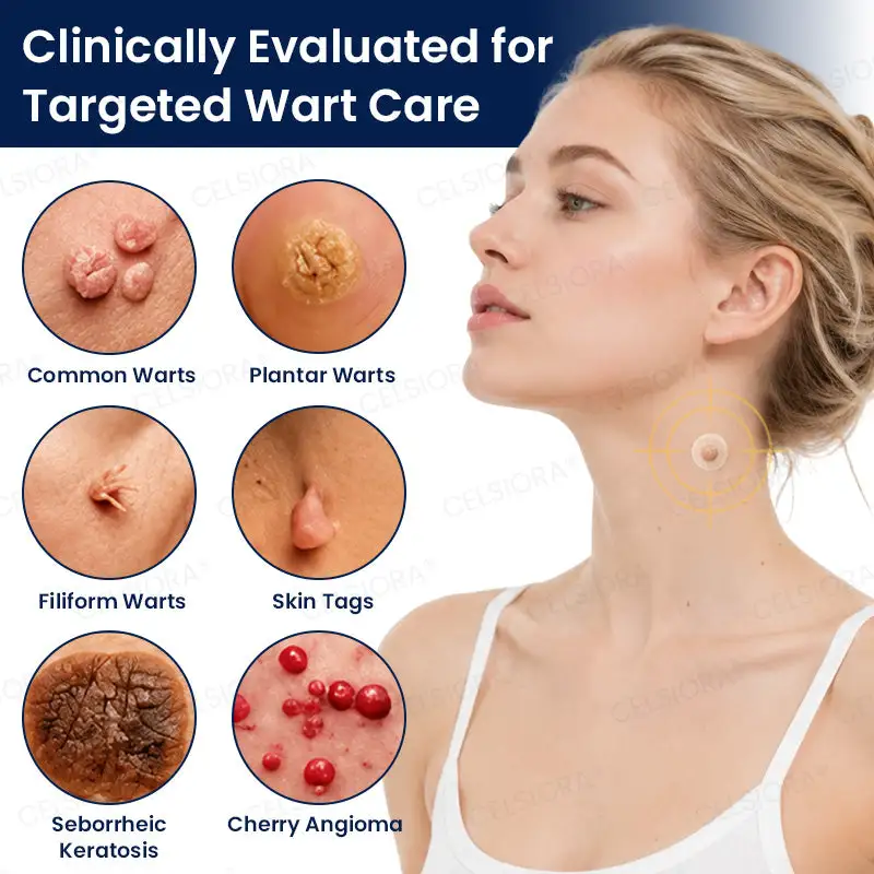 GFOUK® 7-Day MicroNeedle Wart & Skin Tag Removal Patch - Image 7