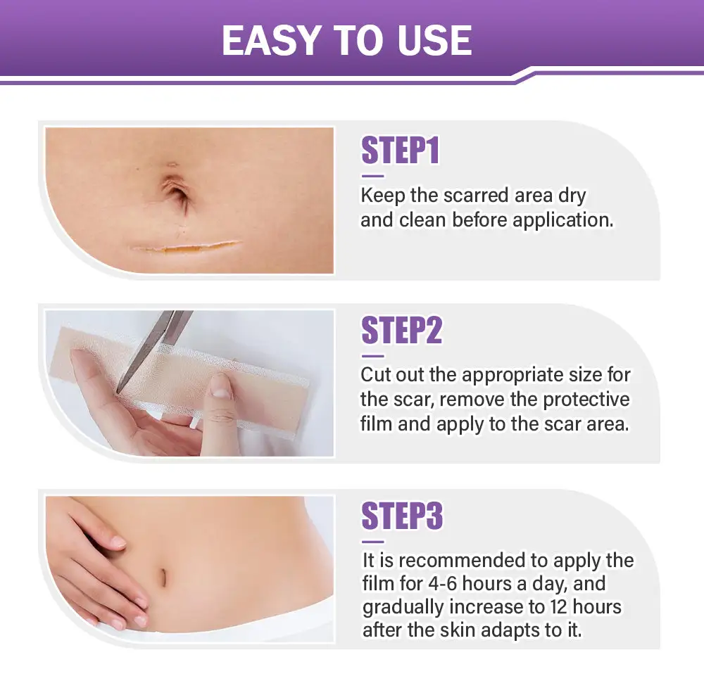 GFOUK® 7-Day Nano Microneedle Scar Repair Tape - Image 10