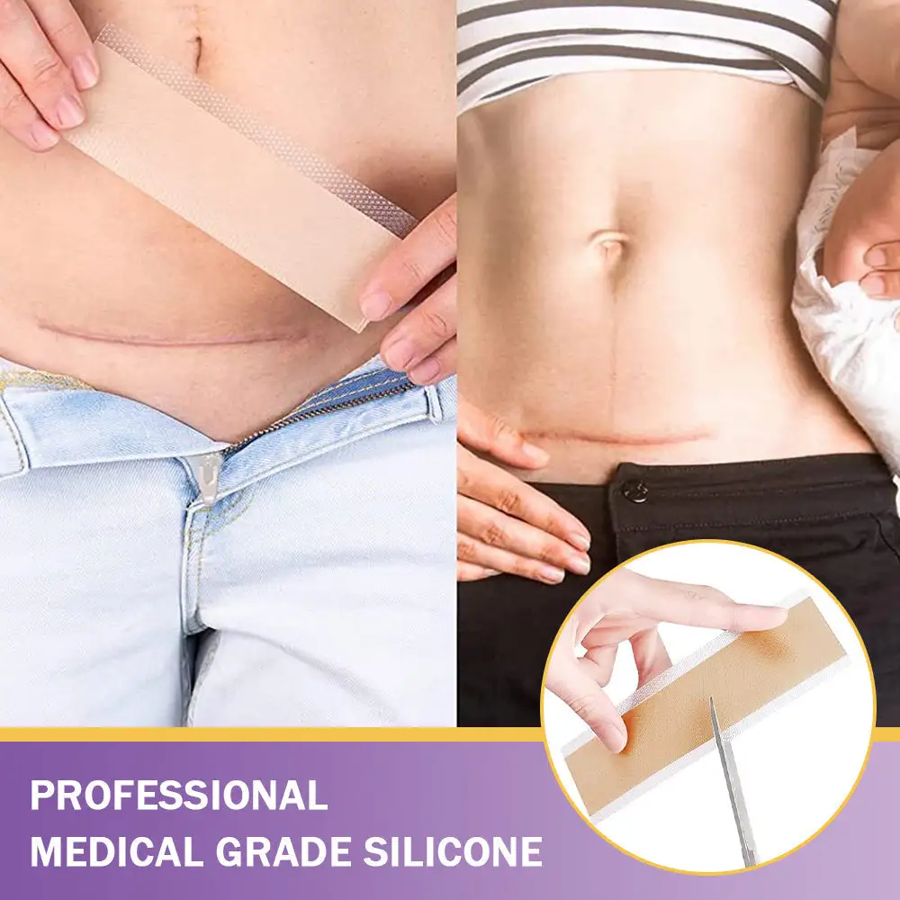 GFOUK® 7-Day Nano Microneedle Scar Repair Tape - Image 8