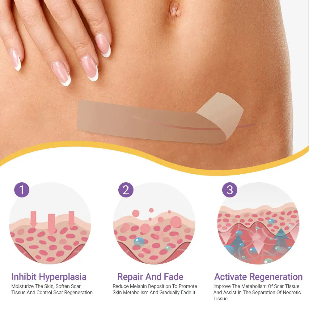 GFOUK® 7-Day Nano Microneedle Scar Repair Tape - Image 9