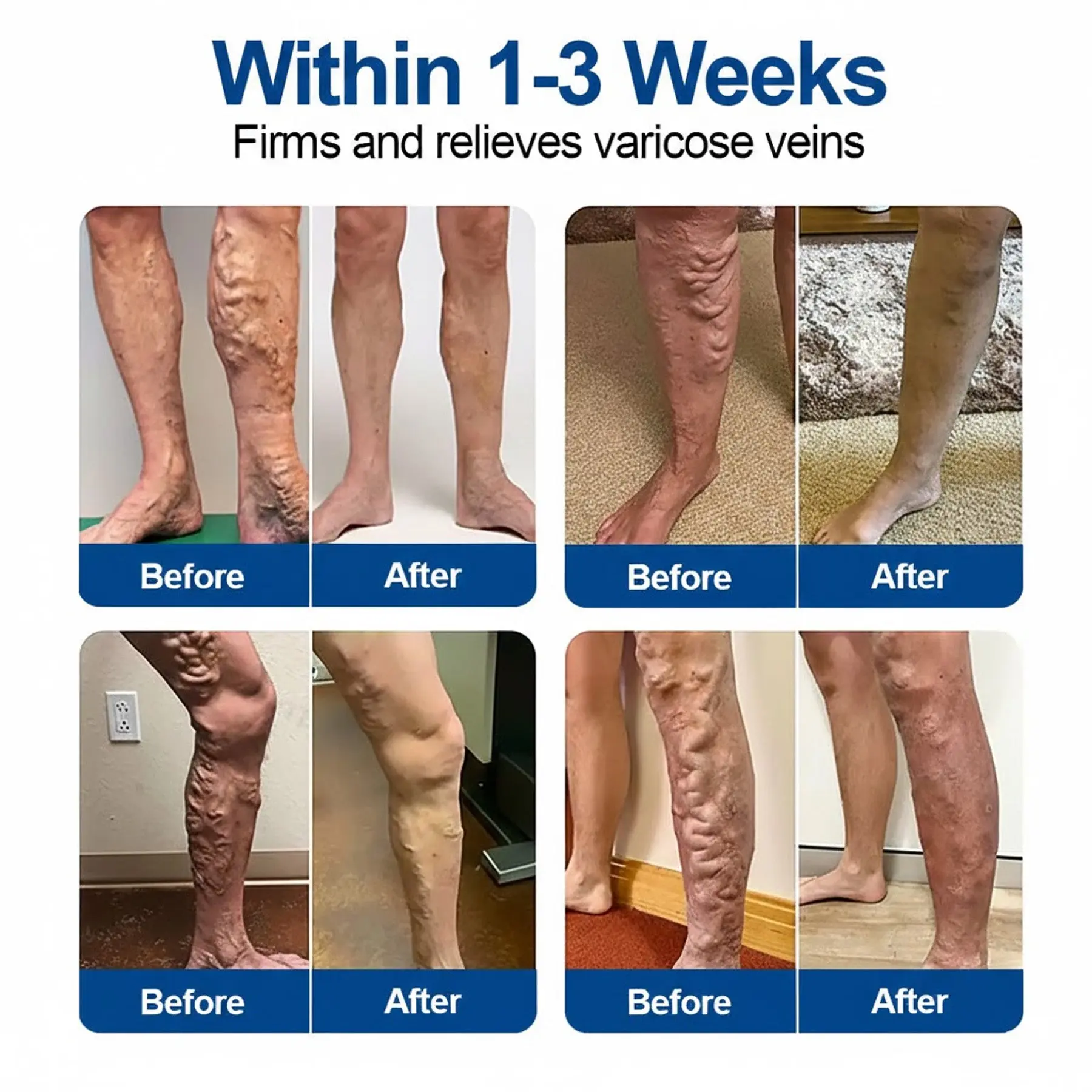 GFOUK® VeinEase Microneedle Care Patch - Image 3