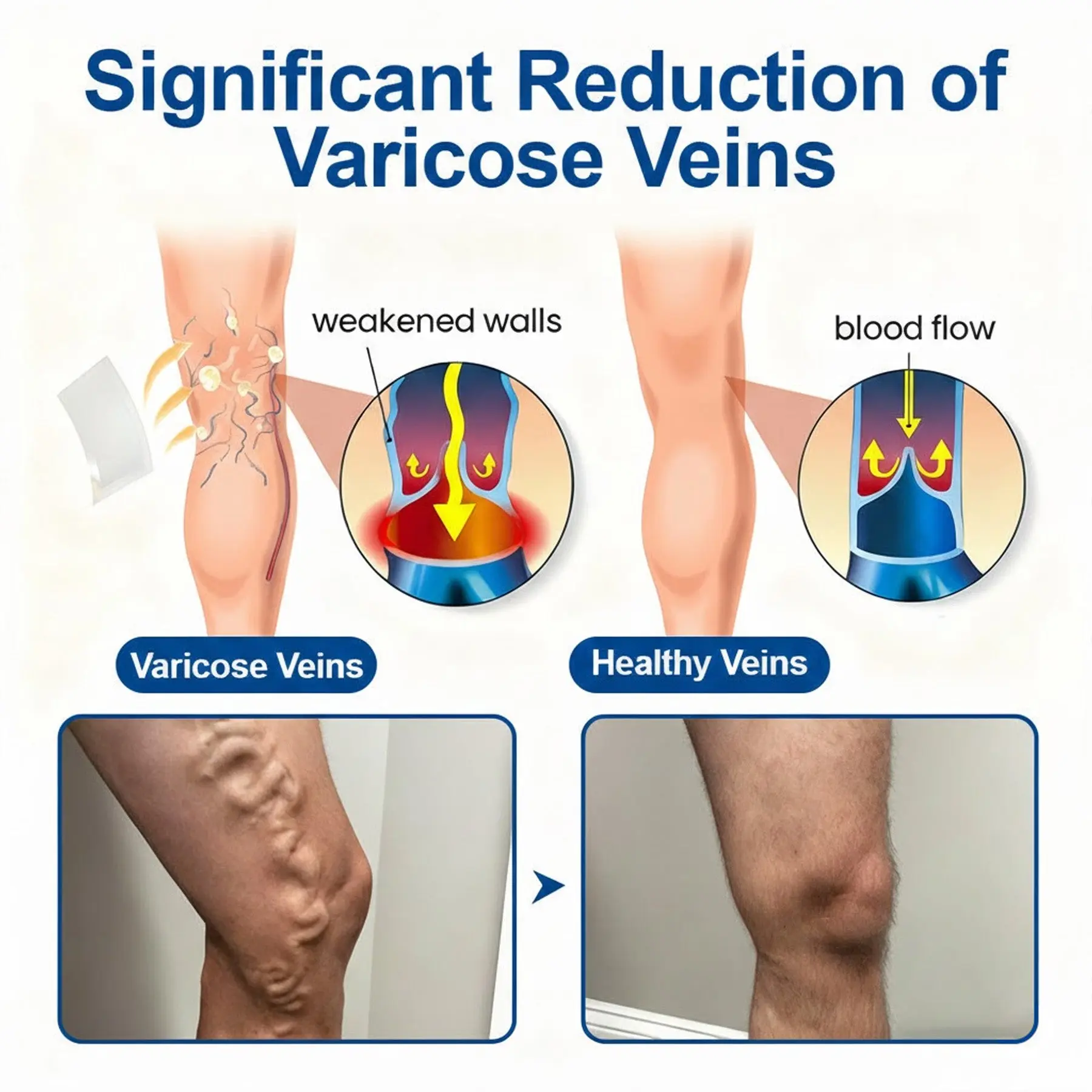 GFOUK® VeinEase Microneedle Care Patch - Image 4