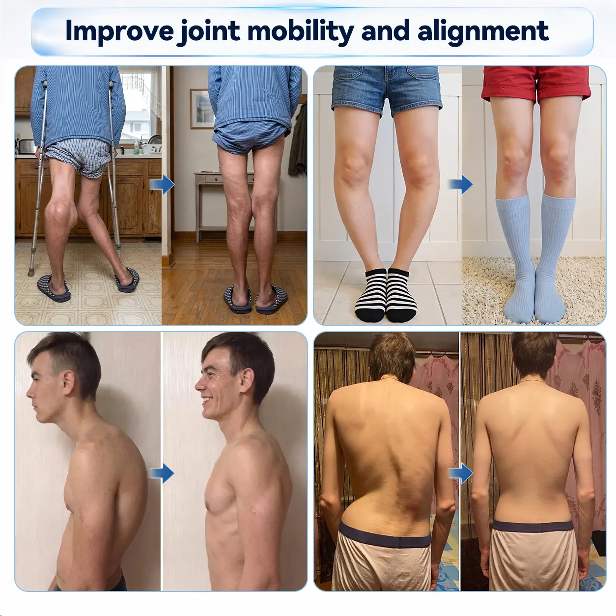 0.05mm Micro-Needle Bone & Joint Recovery Roller - Image 4