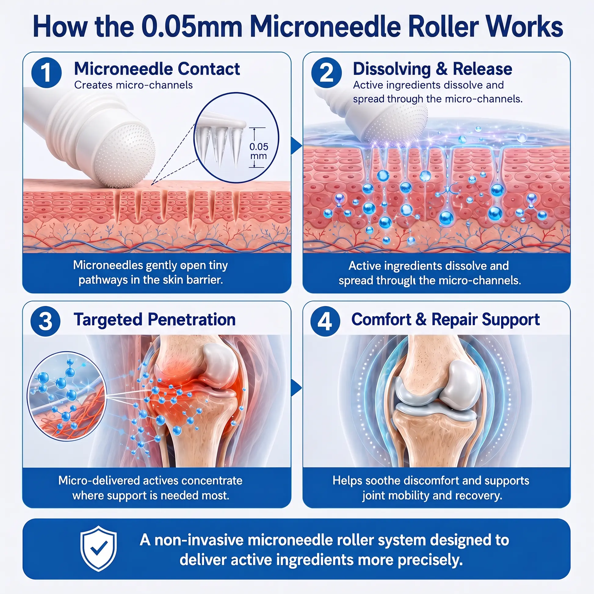 0.05mm Micro-Needle Bone & Joint Recovery Roller - Image 8