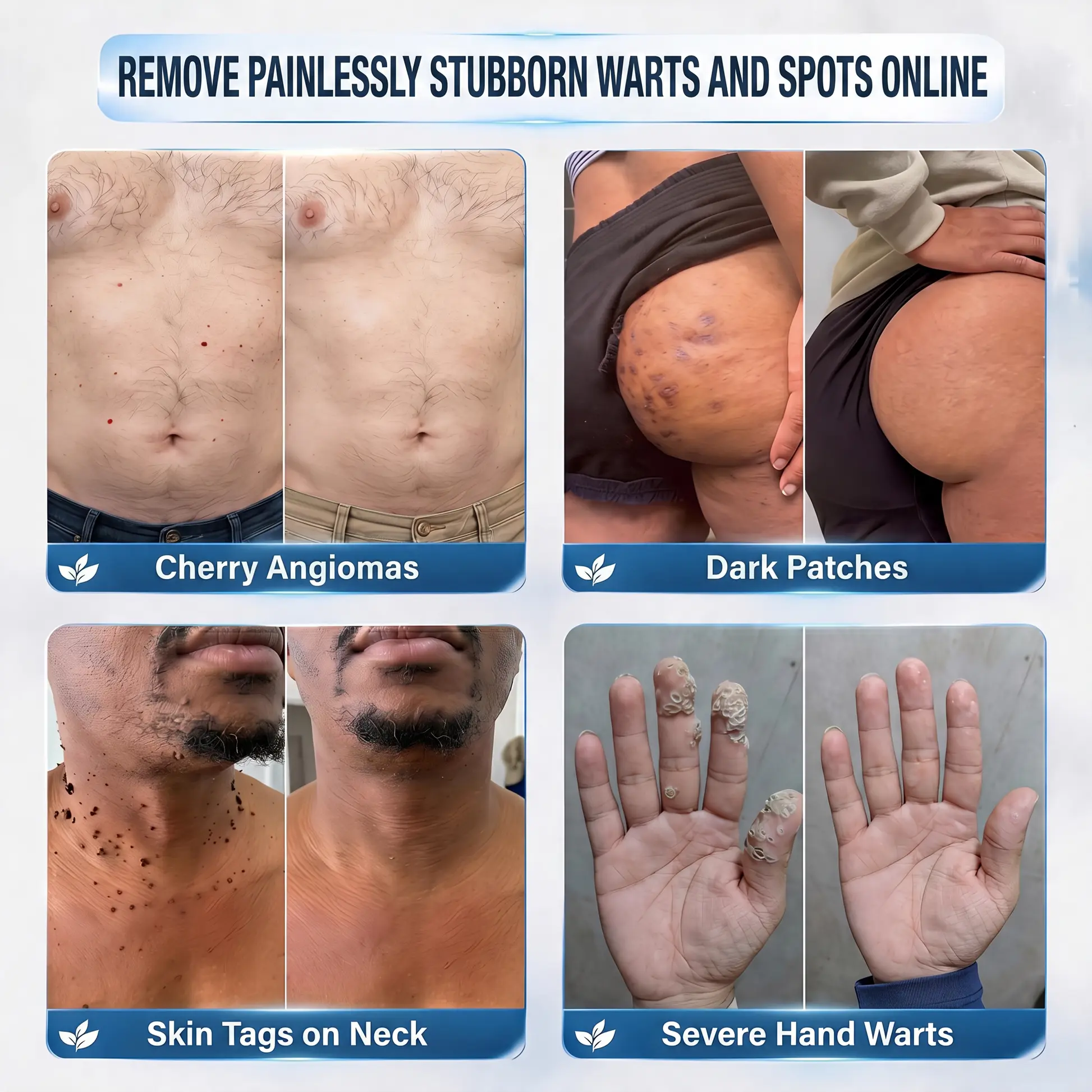 7-Day Skin Tag & Spot Care Cream - Image 2