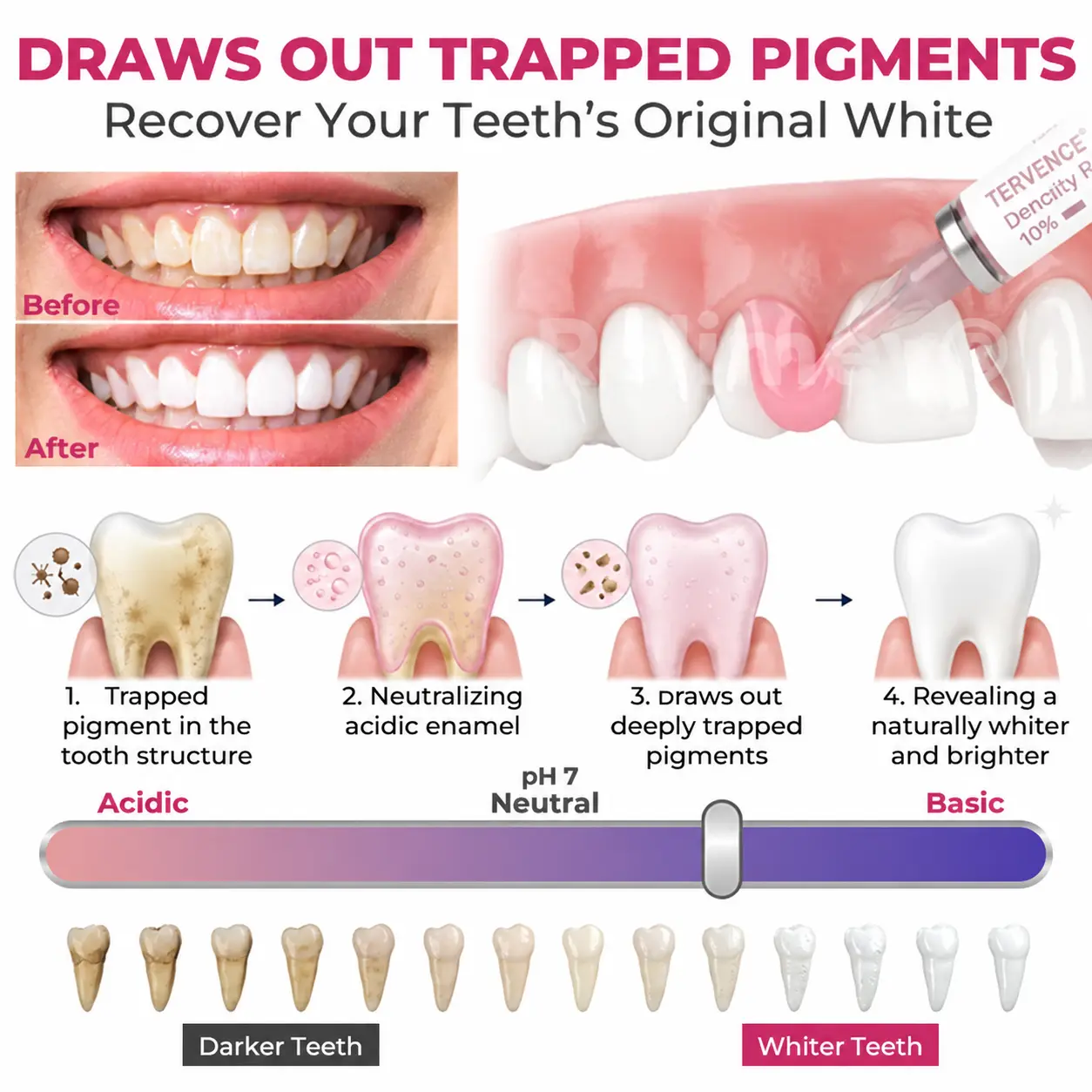 Tervence® Natural Enamel Restoration Gel for Cavity Repair - Image 13