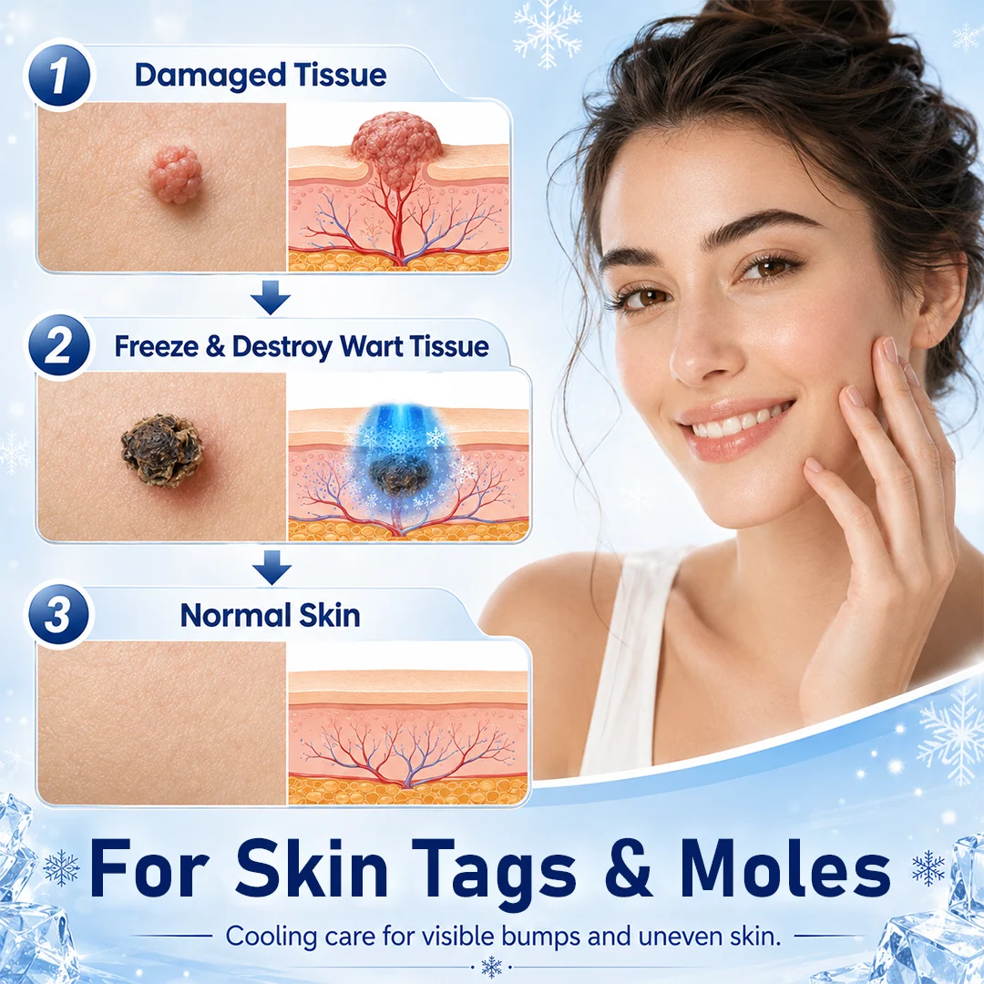 Cougex® CryoClear Pro Bump Renewal Spray - Image 3