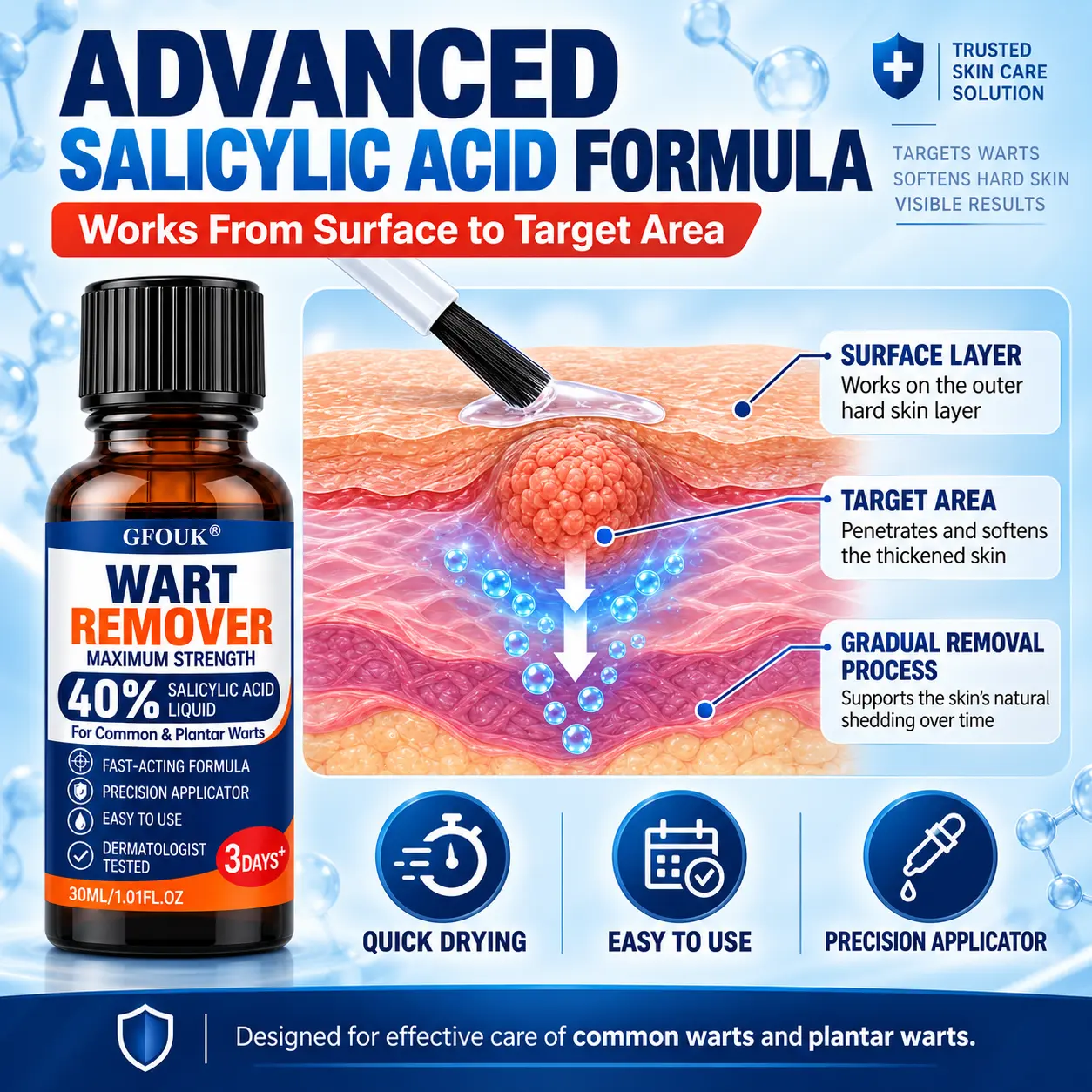 GFOUK®40% Salicylic Acid Wart Remover Liquid - Image 10