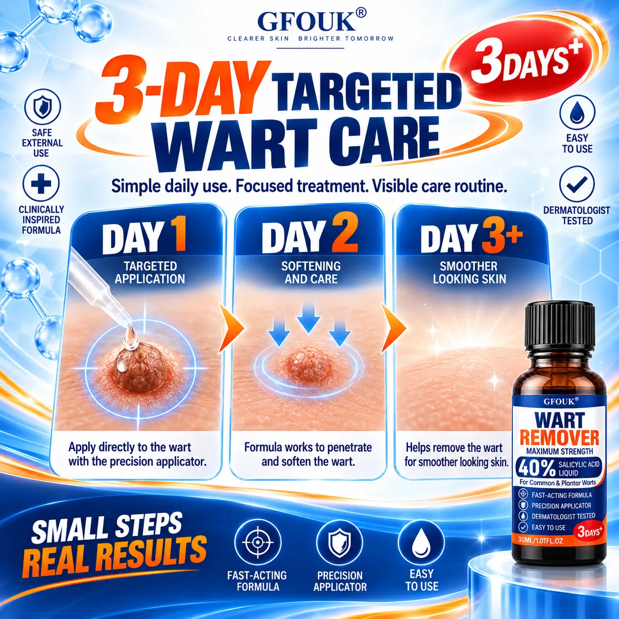 GFOUK®40% Salicylic Acid Wart Remover Liquid - Image 12