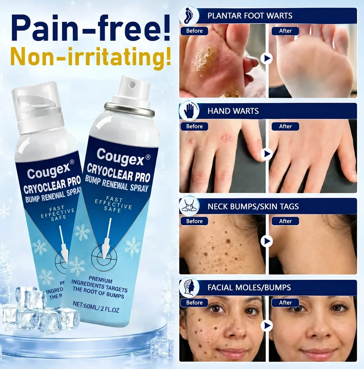 Cougex® CryoClear Pro Bump Renewal Spray - Image 2